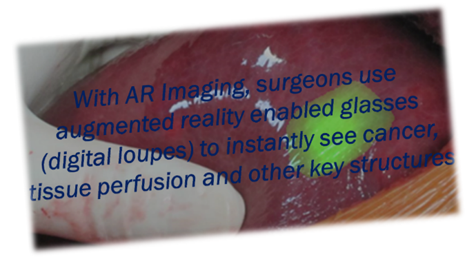 Next Generation Fluorescent and Image Guided Surgery