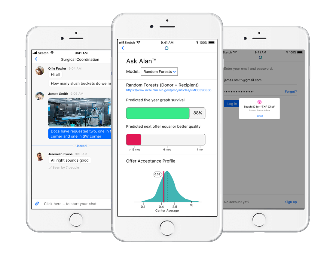 Real time artificial intelligence for organ transplant